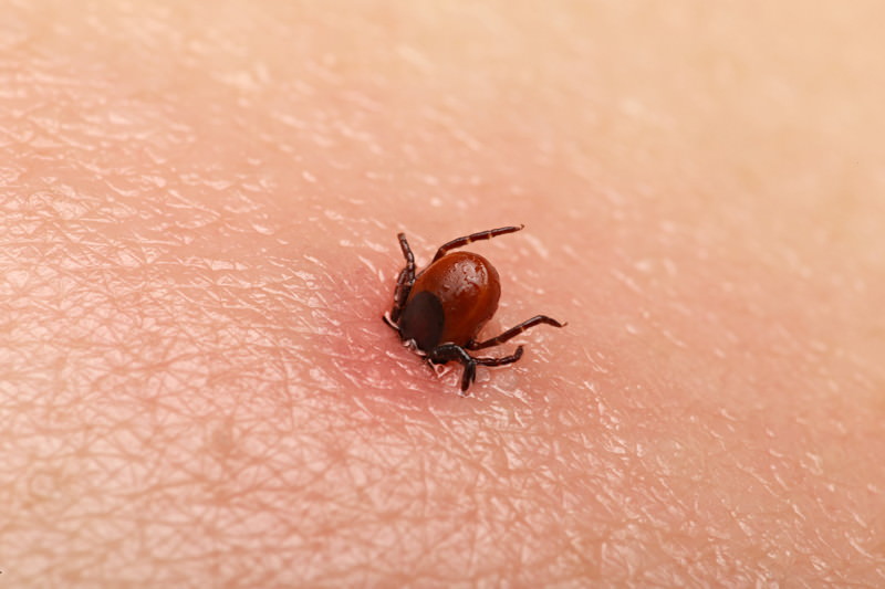 borreliose